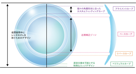 レンズの構造